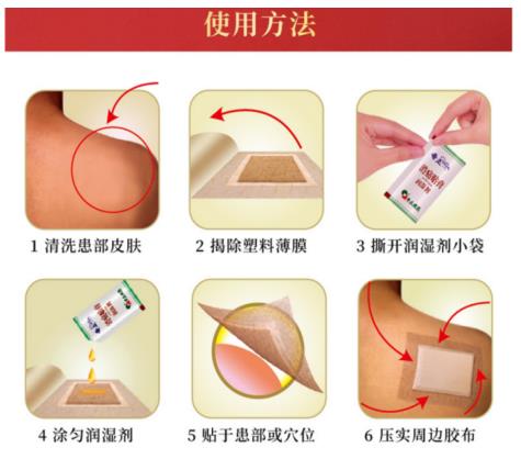 奇正消痛贴膏治疗上有什么特别之处吗？