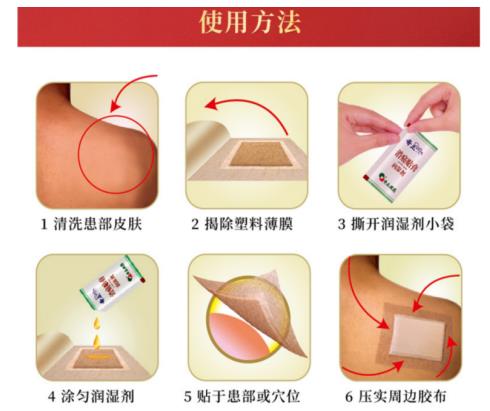 治疗脚腕扭伤可以用奇正消痛贴膏吗