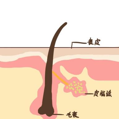 甲硝唑凝胶是抗生素吗?