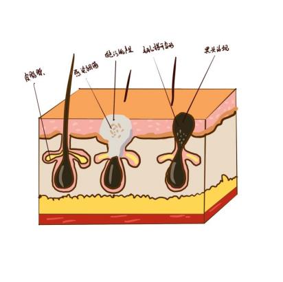 带你了解黑头毛孔粗大怎么解决？