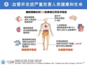 专家权威解读｜糖尿病并发症——隐藏在糖尿病背后的“杀手”